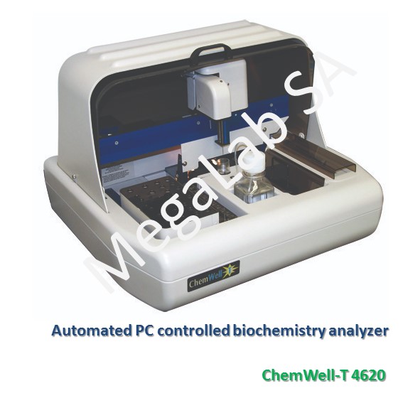 Automated PC controlled biochemistry analyzer